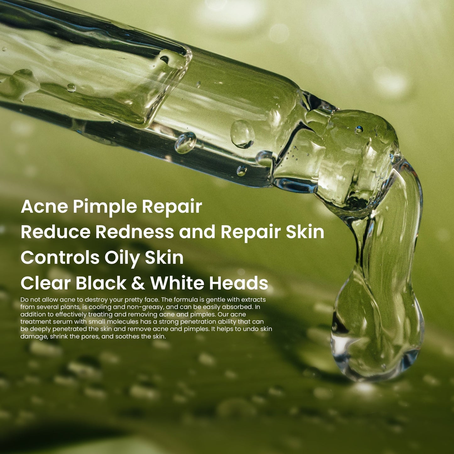 Rivaj - Face Serum - Acne Treatment (30ml)
