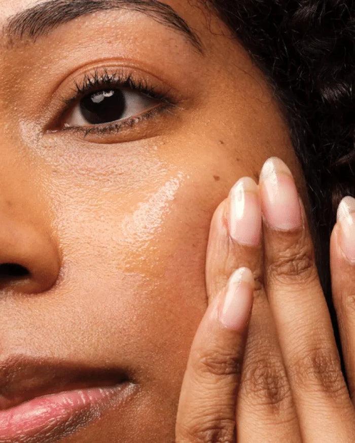 the ordinary Niacinamide 10% + Zinc 1% - thekalisabeauty.com 02