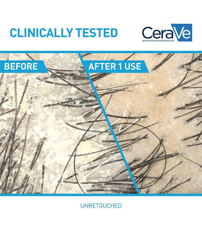 CeraVe - 2-in-1 Anti-Dandruff Hydrating Shampoo and Conditioner