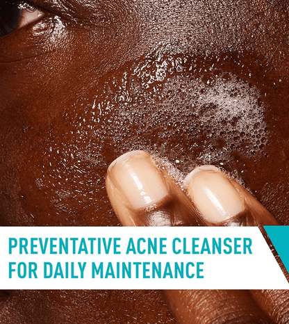 CeraVe - Acne Control Cleanser