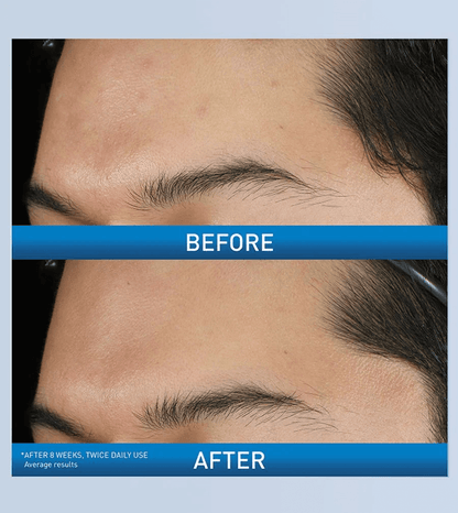 CeraVe - Acne Foaming Cream Wash