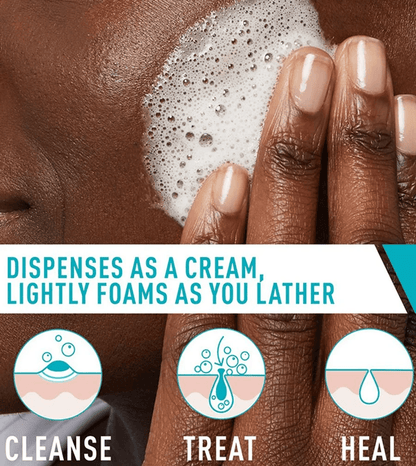 CeraVe - Acne Foaming Cream Cleanser