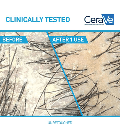 CeraVe - Anti-Dandruff Hydrating Conditioner