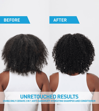 CeraVe - 2-in-1 Anti-Dandruff Hydrating Shampoo and Conditioner