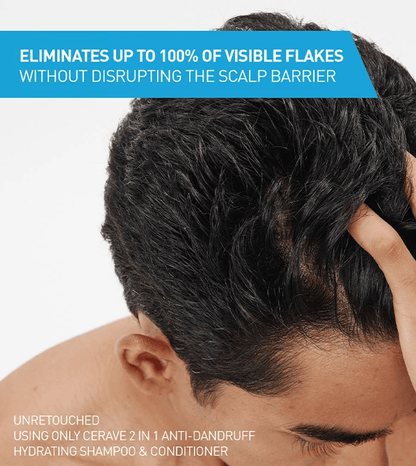 CeraVe - 2-in-1 Anti-Dandruff Hydrating Shampoo and Conditioner