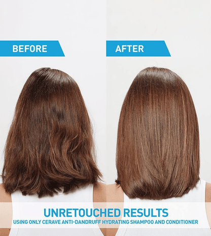 CeraVe - Anti-Dandruff Hydrating Shampoo