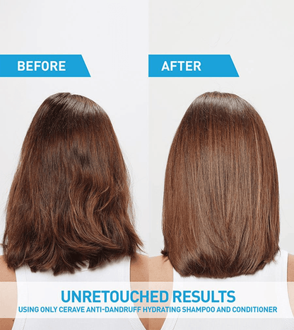 CeraVe - Anti-Dandruff Hydrating Conditioner