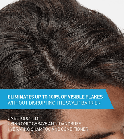 CeraVe - Anti-Dandruff Hydrating Shampoo